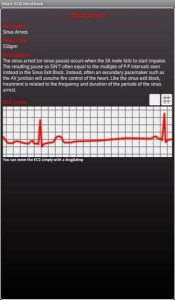 <b>Heart ECG Handbook v3.0.5</b>